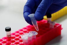 Un organisme de surveillance de la concurrence au Royaume-Uni enquêtera sur le «comportement d'exploitation» parmi les fournisseurs de tests de PCR Covid sur les voyages