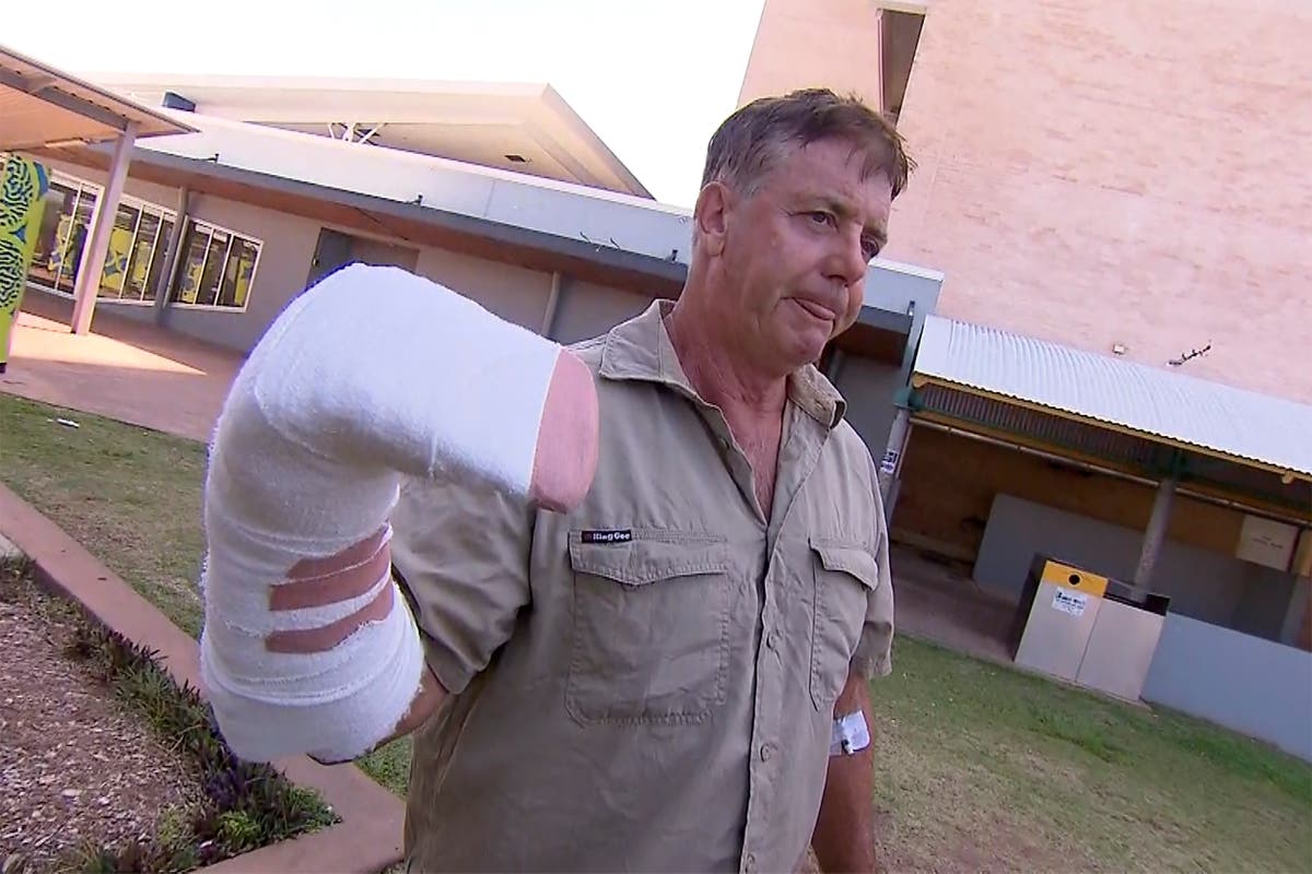 Australian 'a bit sore' after hand was caught in croc's jaws