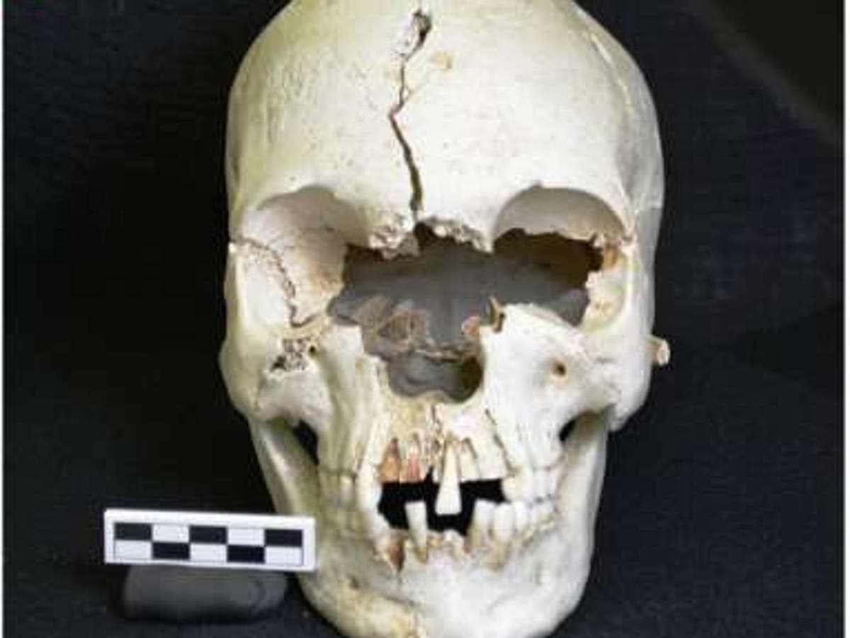 在无人居住的加勒比岛上发现的古代头骨显示麻风病的证据