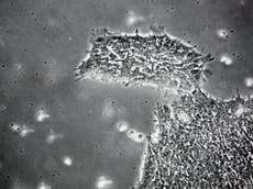 ‘Landmark’ study sheds new light on vital stage of human embryo development 