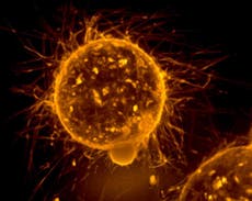 Cancer cells suck mitochondria out of immune cells using ‘tiny tentacles’, estudo diz