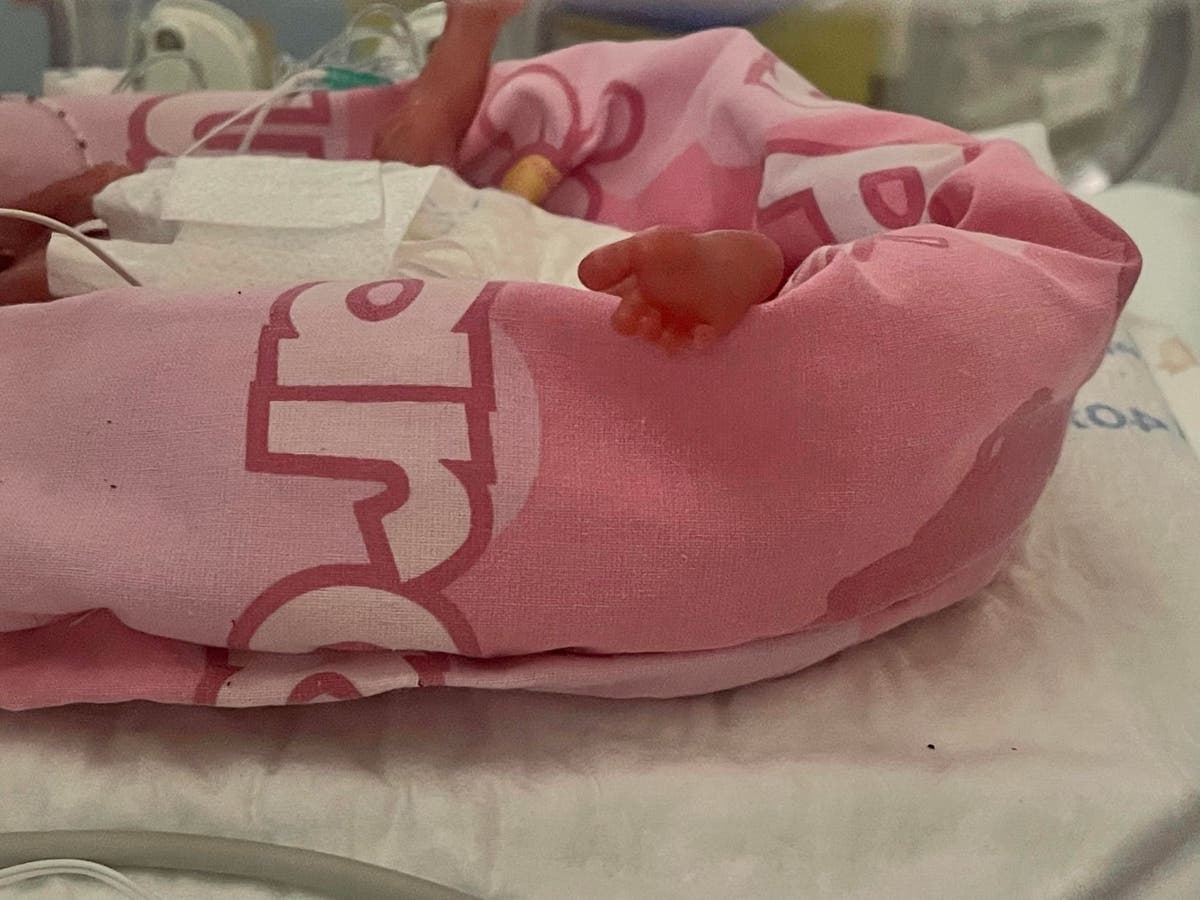 Parents of UK’s smallest premature baby born weighing 325g finally able to hold her