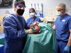 Man receives first successful transplant of pig heart into human body