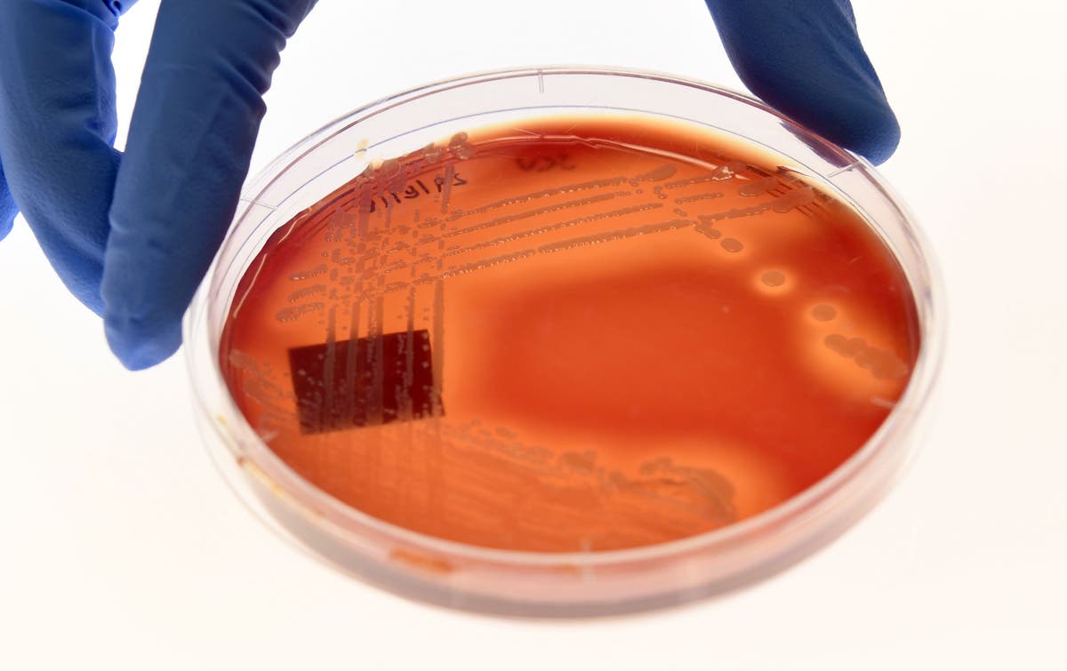 Antibiotic-resistant superbugs caused 1.2 million deaths in a year, study finds