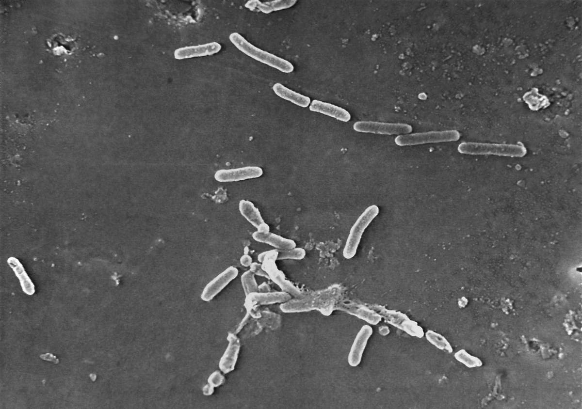 調査: Drug-resistant bacteria kill 1.2 世界で百万