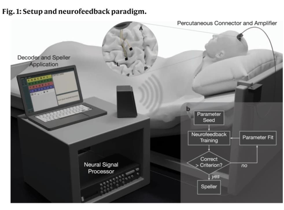 <p>The patient was provided auditory feedback of neural activity levels through a nearby speaker, which allowed them to adjust frequencies to generate ‘yes’ and ‘no’ responses</s>