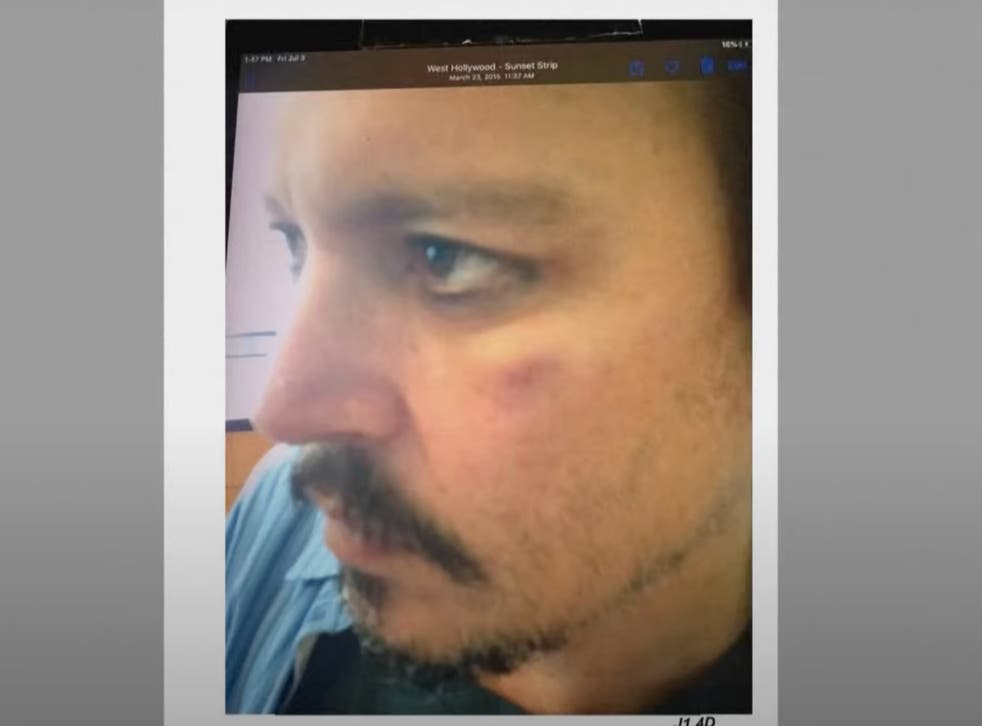 <p>A photo of Johnny Depp shows the actor after receiving what he called a ‘roundhouse punch’ by Amber Heard</p>