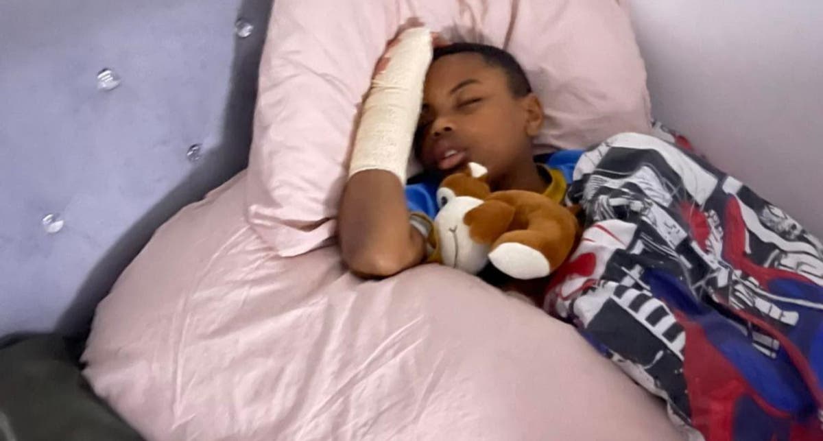 Black boy, 11, loses finger while fleeing ‘school bullies’