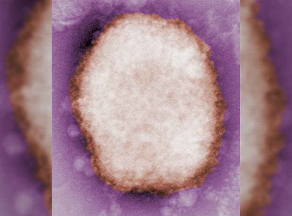 <p>A monkeypox virus particle viewed under a microscope </p>