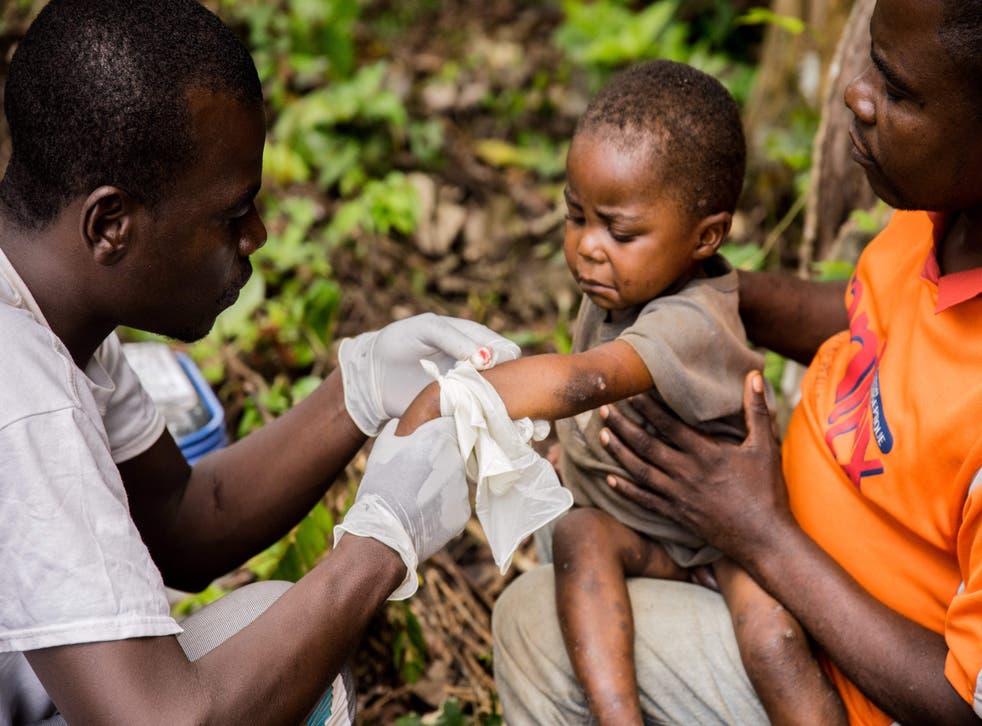 <p>A child affected by monkeypox receiving treatment in Zomea Kaka, in the Lobaya region, in the Central African Republic on 18 October 2018</bl>