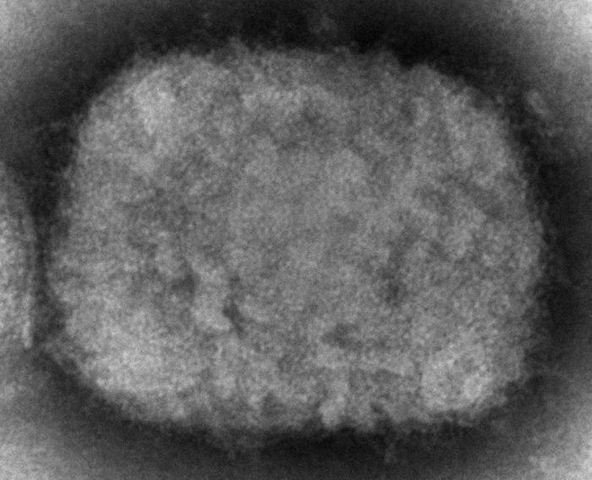 EU regulator considers clearing smallpox shot for monkeypox