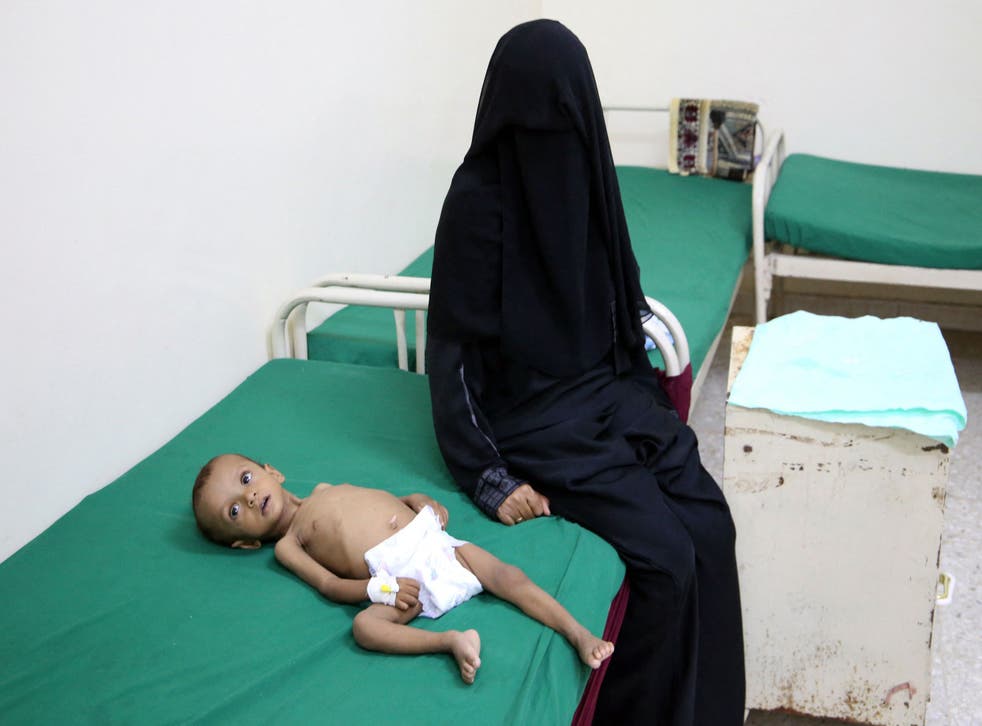 <p>A woman sits next to a malnourished child, lying on a bed at a treatment centre, in the village of Hays in Yemen’s war-ravaged western province of Hodeida</p>