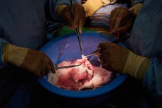 Pig organ transplants inch closer with testing in the dead