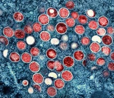イギリス: 'Early signs' that monkeypox outbreak may be peaking