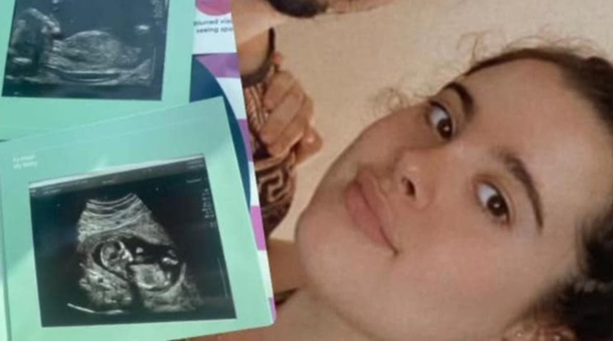 妊婦 , 25, 自宅での「てんかん発作」の後、胎児が突然死亡