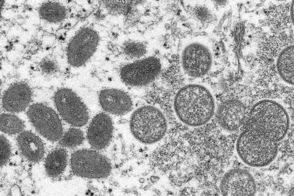 Africa CDC says renaming of monkeypox variants curbs stigma