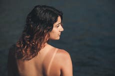 Mild sunburn can’t cause cancer and four other myths to stop believing
