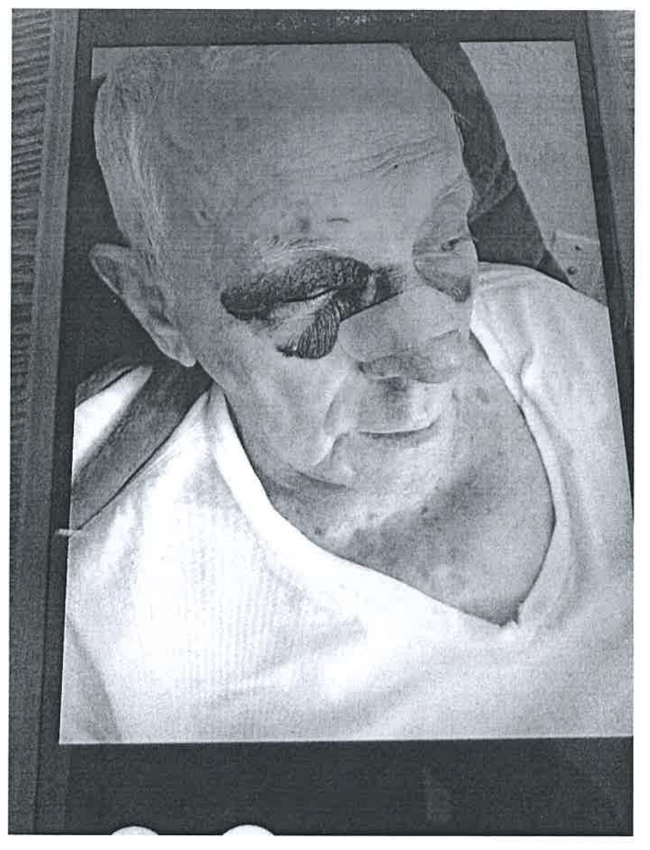 Bowlds, 84, broke his nose and tore his rotator cuff in a fall after getting distracted by a Waffle House ad, according to a lawsuit