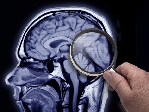 brain-magnifying-glass