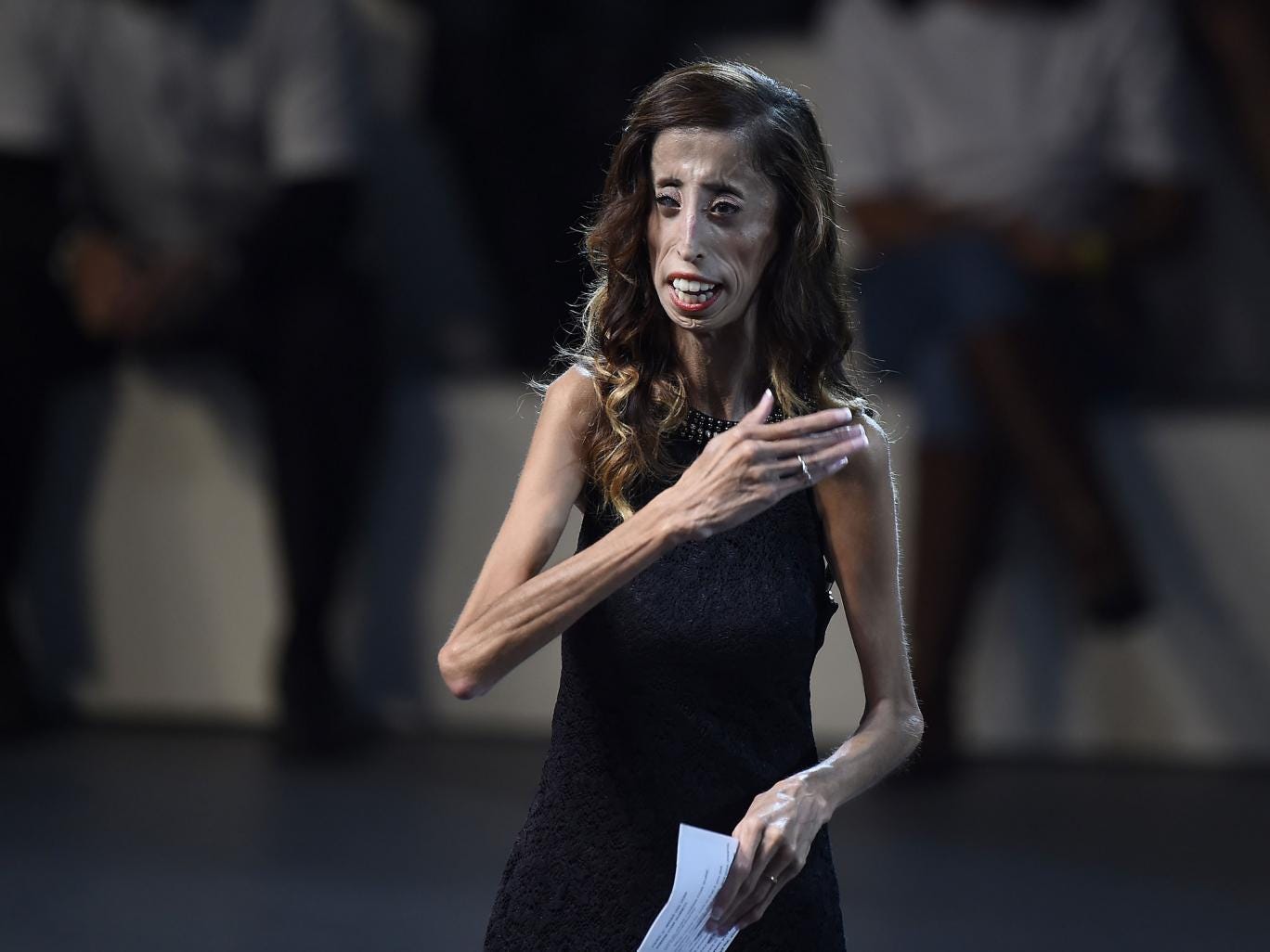 Lizzie Velasquez delivers a speech during a conference at the National Auditorium in Mexico city, on September 5, 2014