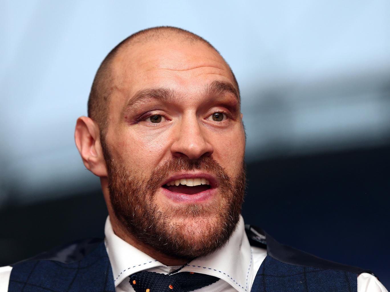 Tyson Fury Labels Those Who Signed BBC SPOTY Award Petition As 'w ...