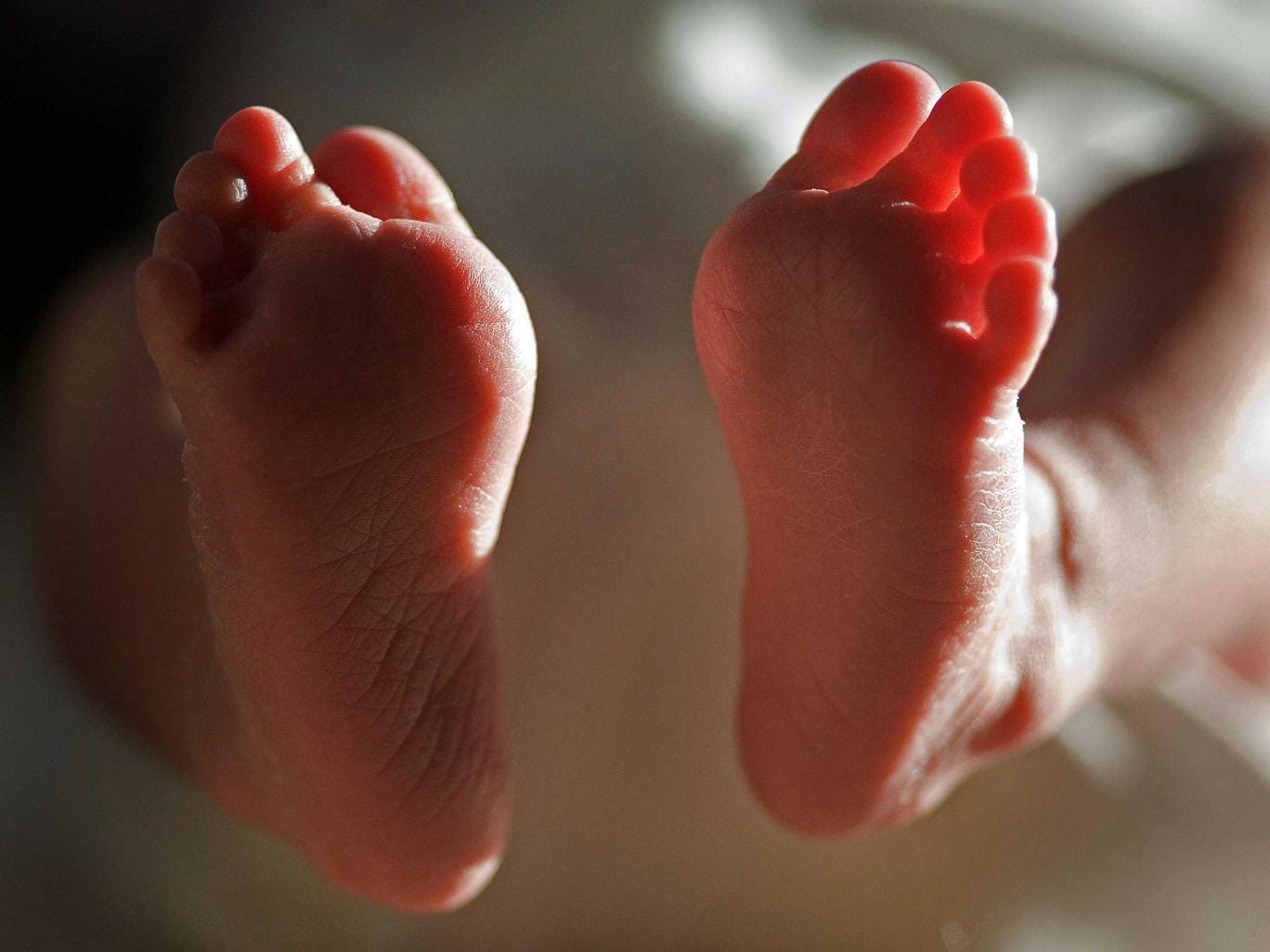 Scurvy can be caused by a diet deficient in vitamin C. 