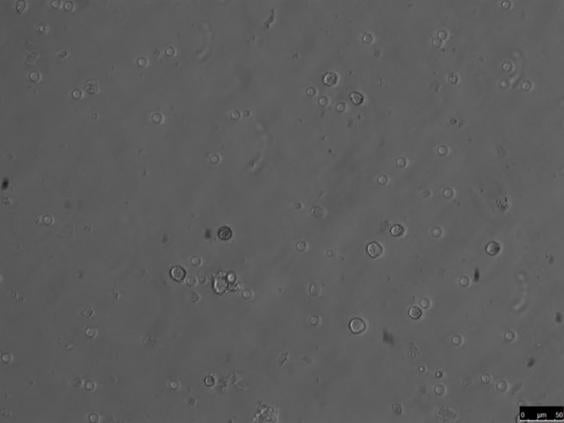 8-sperm-cells-ap.jpg