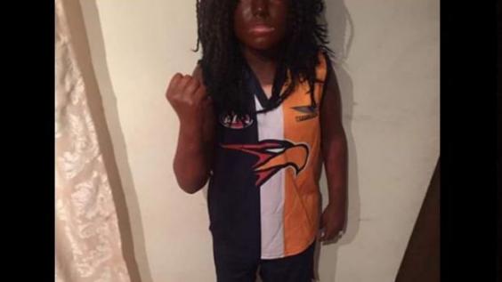 Aboriginal Mother Shares Whiteface Facebook Picture…