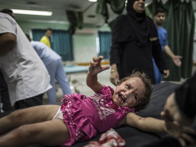 A Palestinian child screams in pain at the Kamal Adwan hospital in Beit Lahia in the northern Gaza Strip after she was hit by shrapnel during an Israeli military strike near her family house   