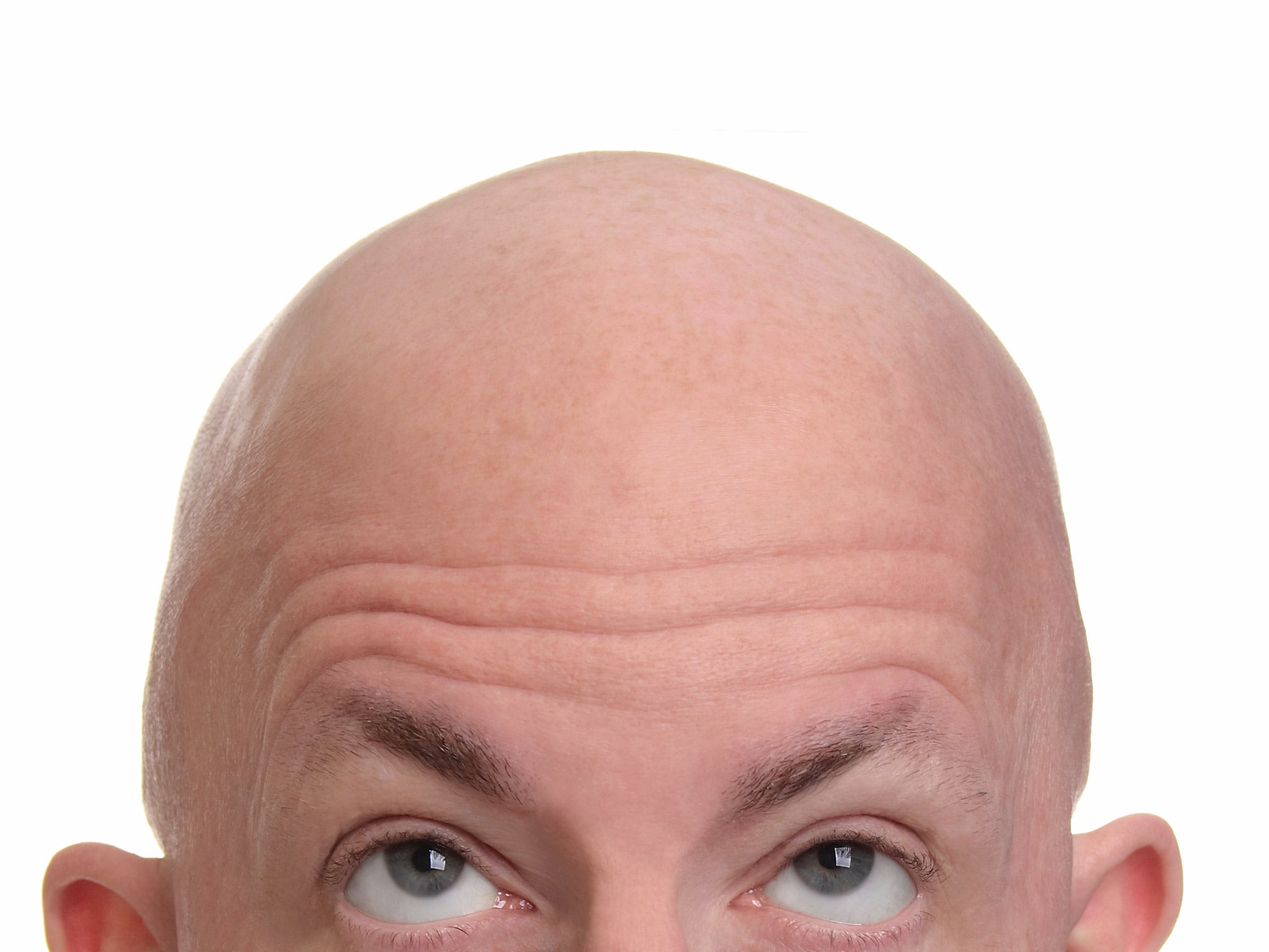 Baldness And Thinning Hair Are Due To Aging Dna Study Finds The
