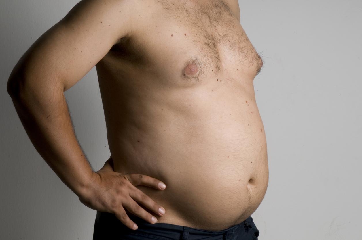кортизоловый живот у мужчин фото