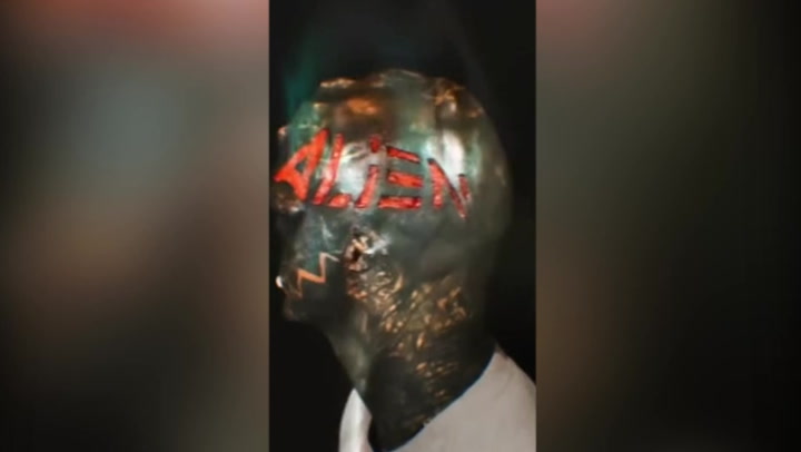 Autoproclamado 'Black Alien' tem nome esculpido em carne na cabeça
