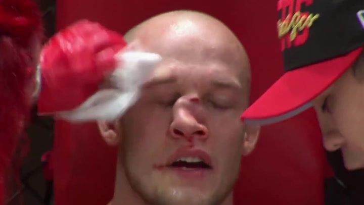 MMA fighter Blake Perry continues despite badly broken nose