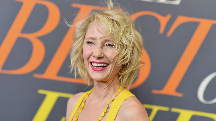 Anne Heche suffers severe burns after crashing car into house in LA, reports claim