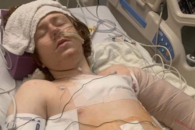 The boy's mother released images of him in hospital after the shooting