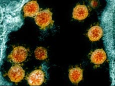  Antibody that could neutralise coronavirus found by University of Pittsburgh