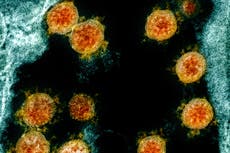 Antibody that could neutralise coronavirus found by University of Pittsburgh