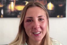 French woman punched in face by three men ‘for wearing skirt’