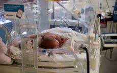 Babies’ skulls fractured in traumatic births, report reveals