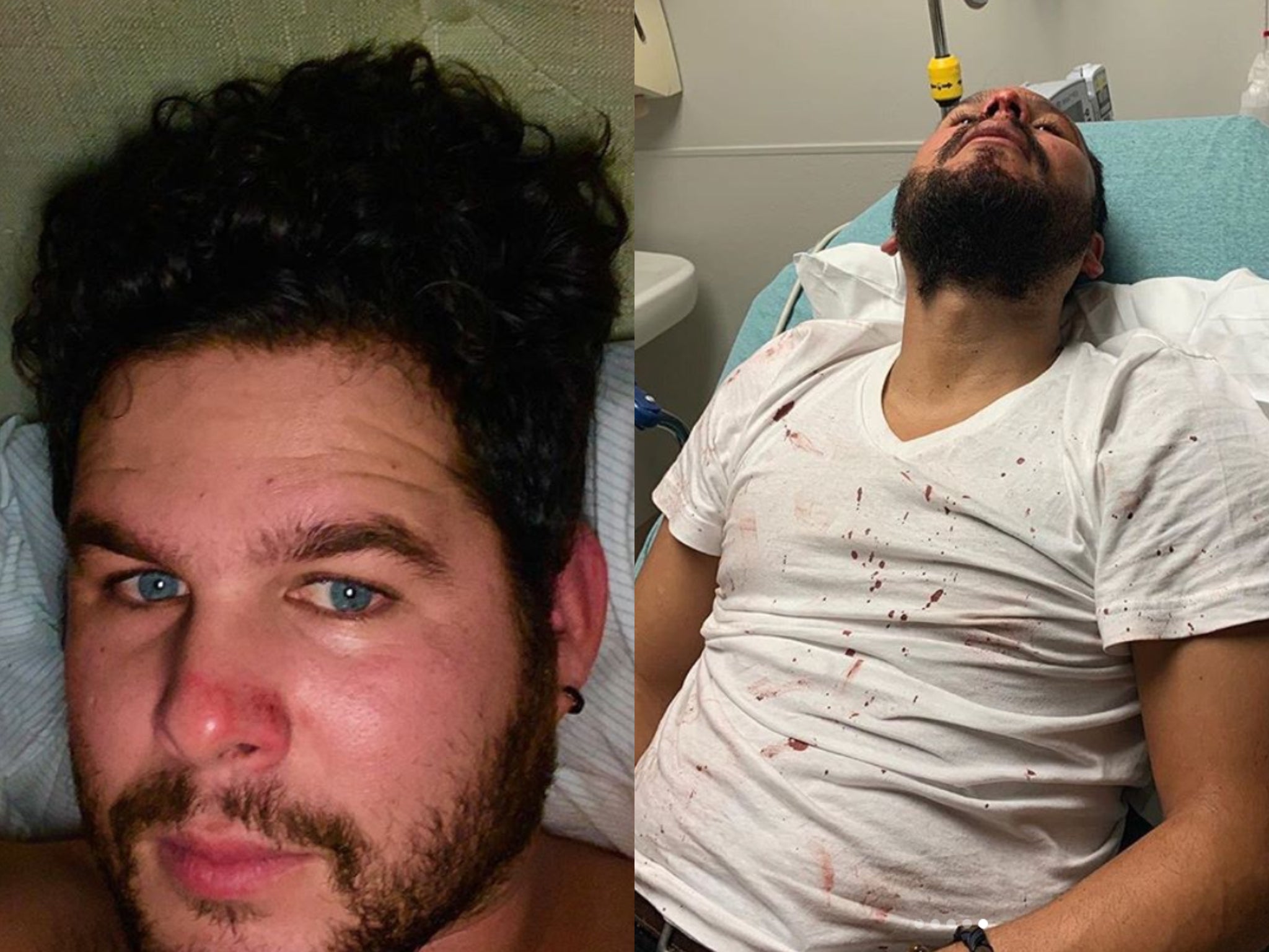 The Mavericks trumpet player Lorenzo Molina was assaulted in a Tennessee sports bar