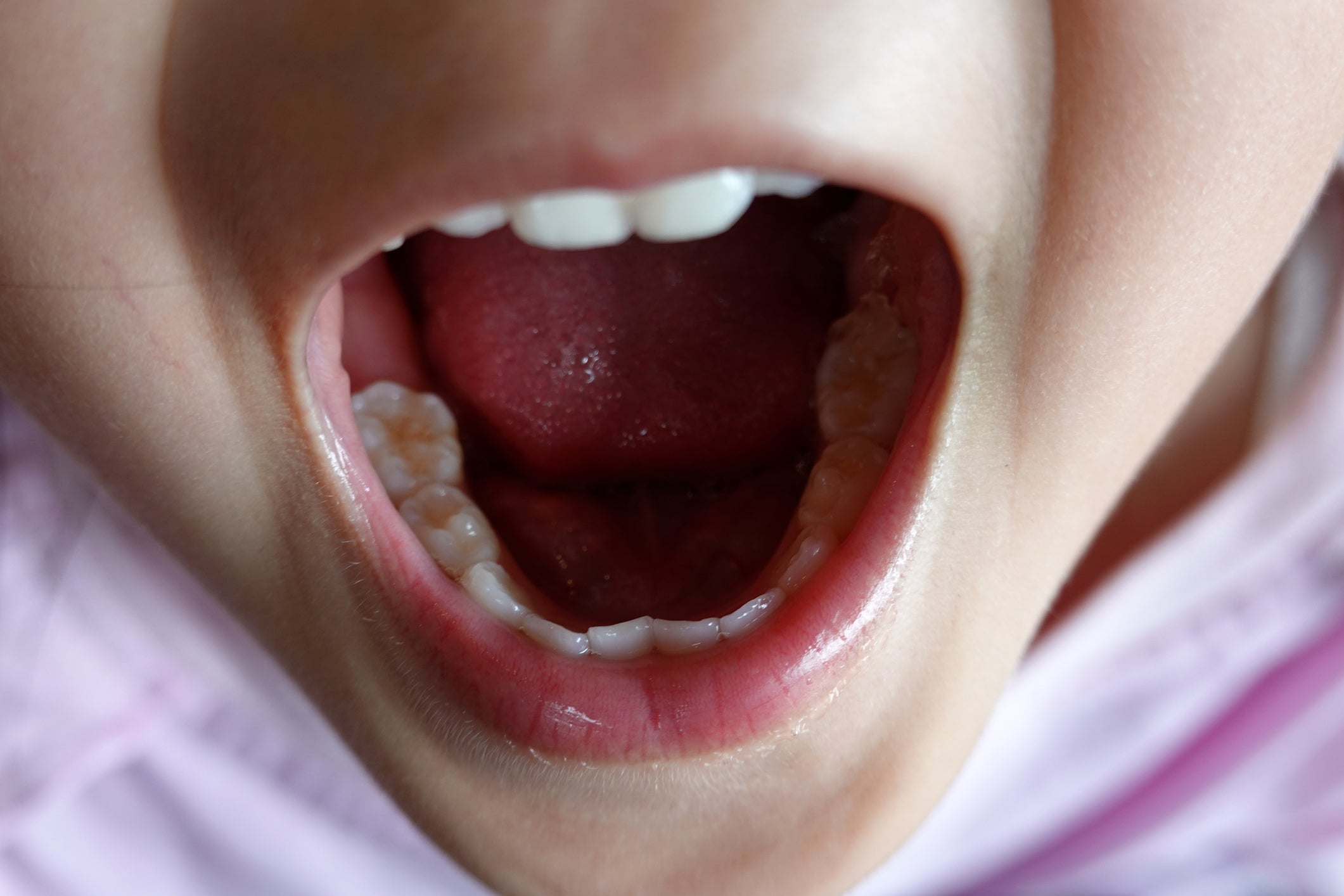 File photo: According to the NHS, babies’ bottom teeth are the first to arrive, usually at around five-to-seven months