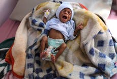 Rate of starving children in Yemen reaches new high, UN warns