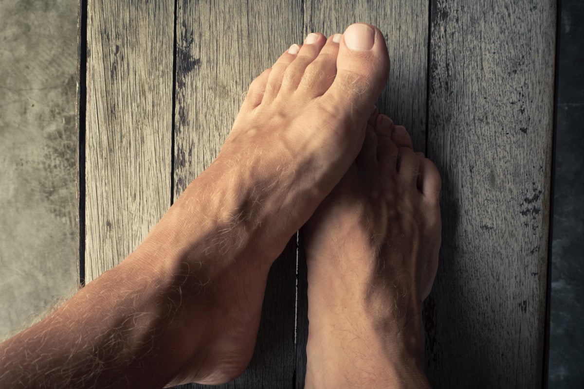 Covid toes: What is chilblain and what are the symptoms? | The Independent