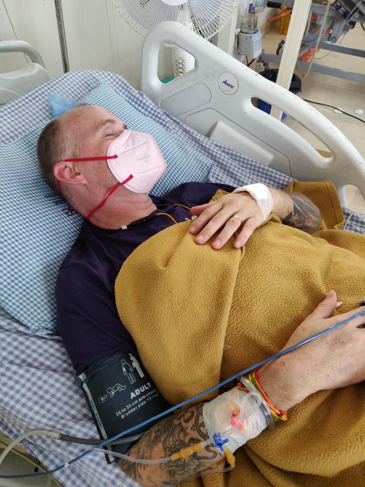 British man blinded and paralysed after snakebite while battling suspected  Covid in India | The Independent