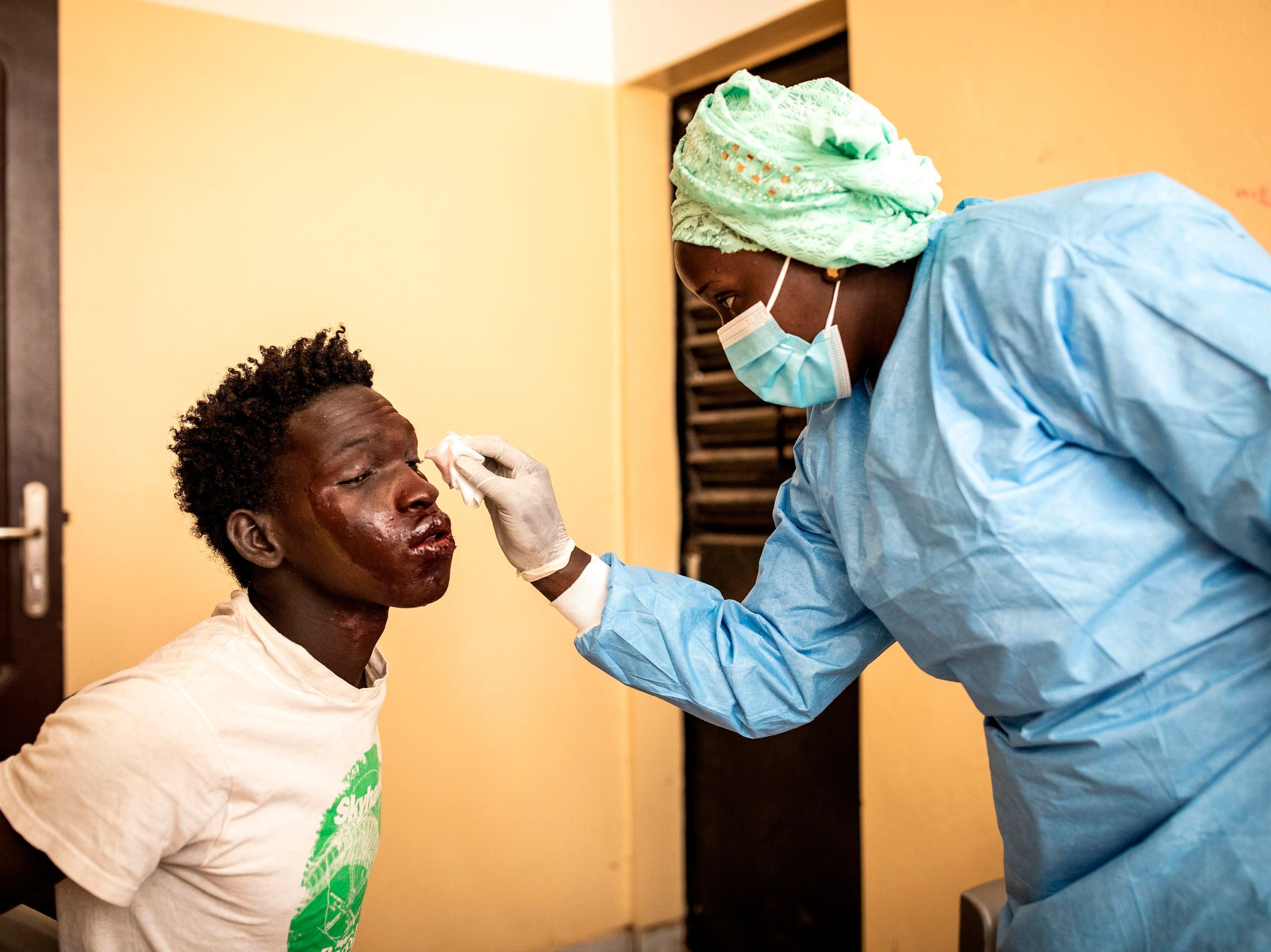 A fisherman receives medical treatment for a mysterious skin disease in Dakar