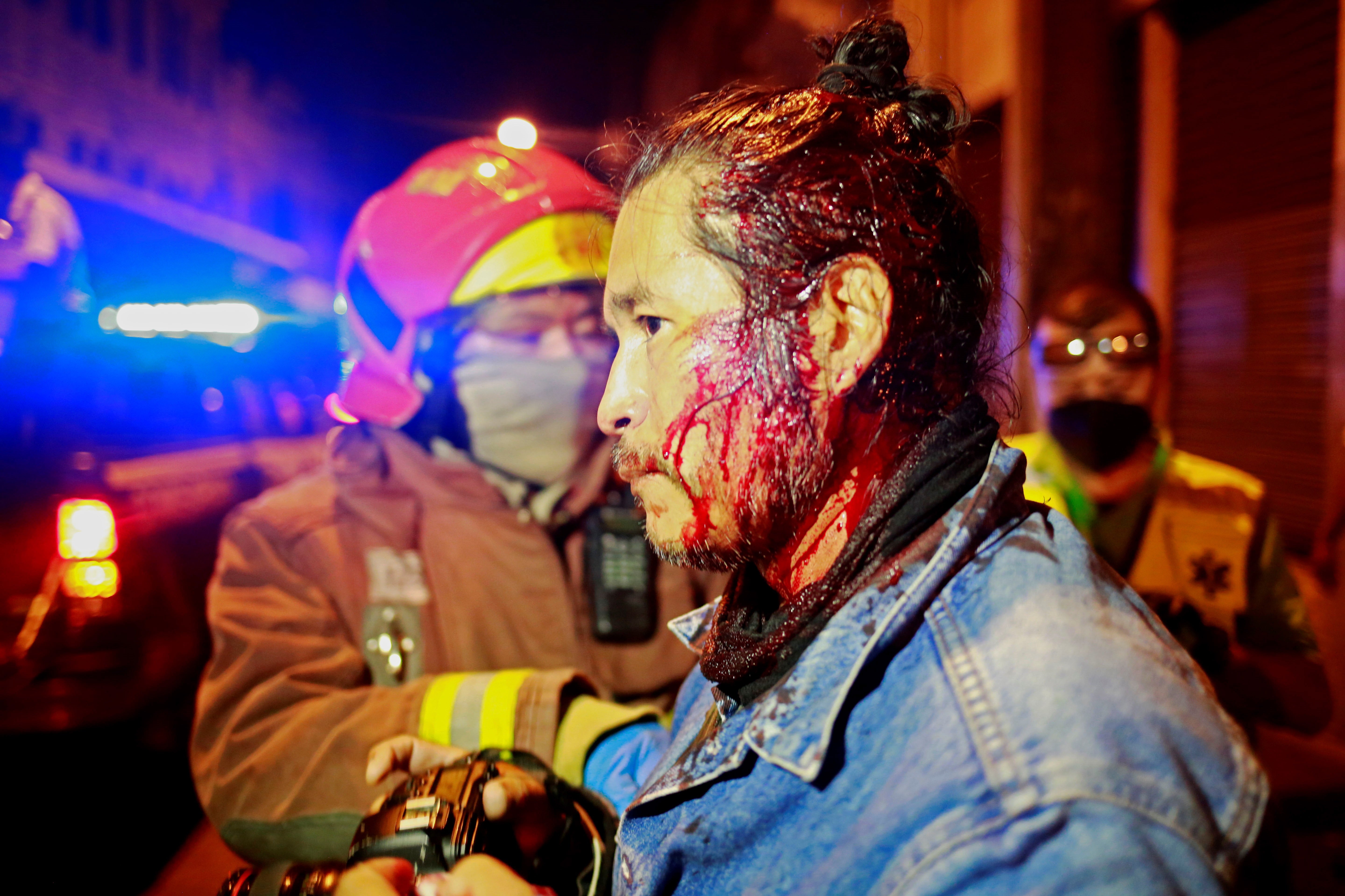 A protestor is given medical treatment after the Congress building in Guatemala City was set alight.