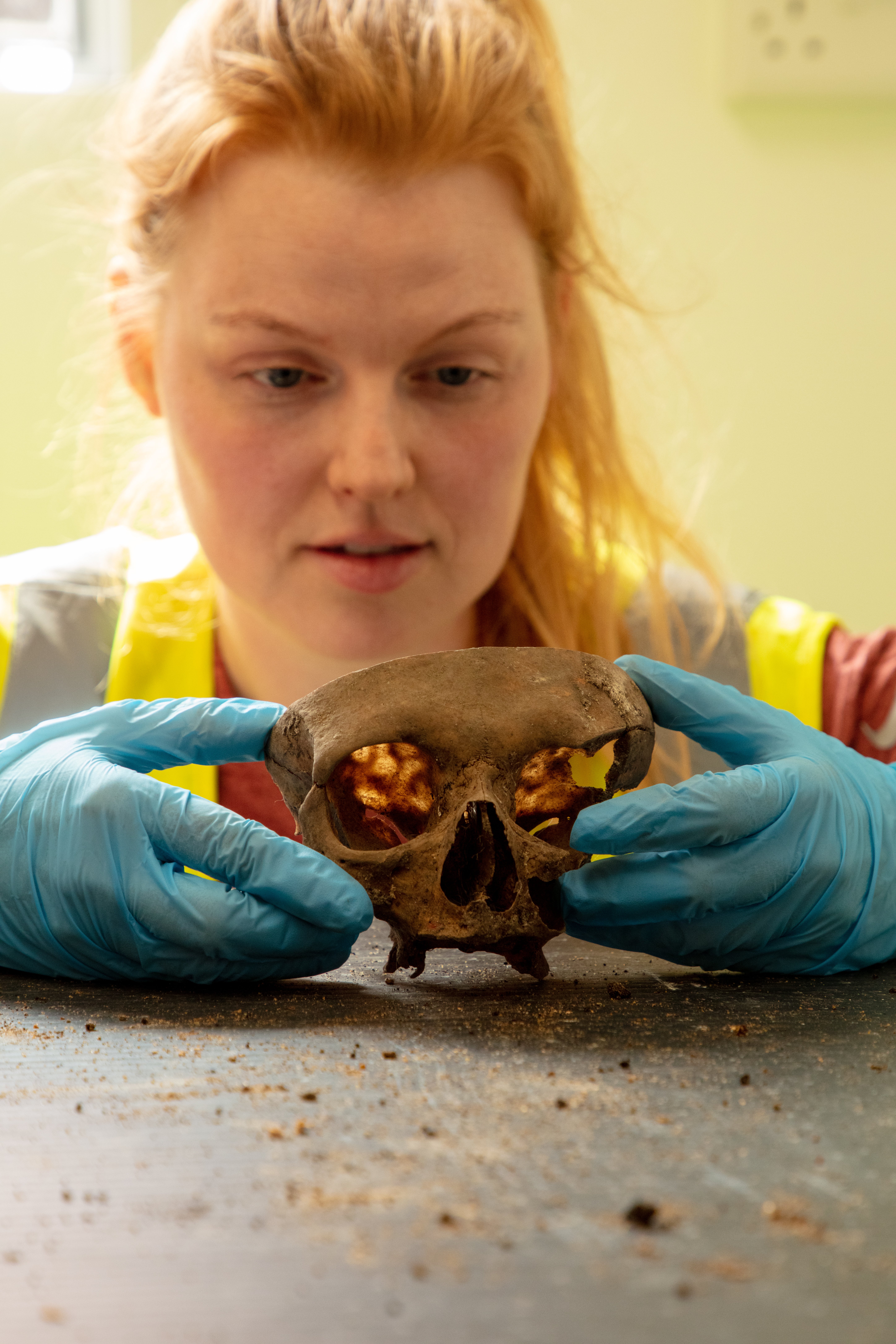 Osteoarchaeologist Erna Johannesdottir examines a skull demonstrating evidence of a craniotomy procedure