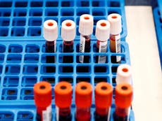 NHS to trial ‘game-changer’ blood test for cancer in 2021