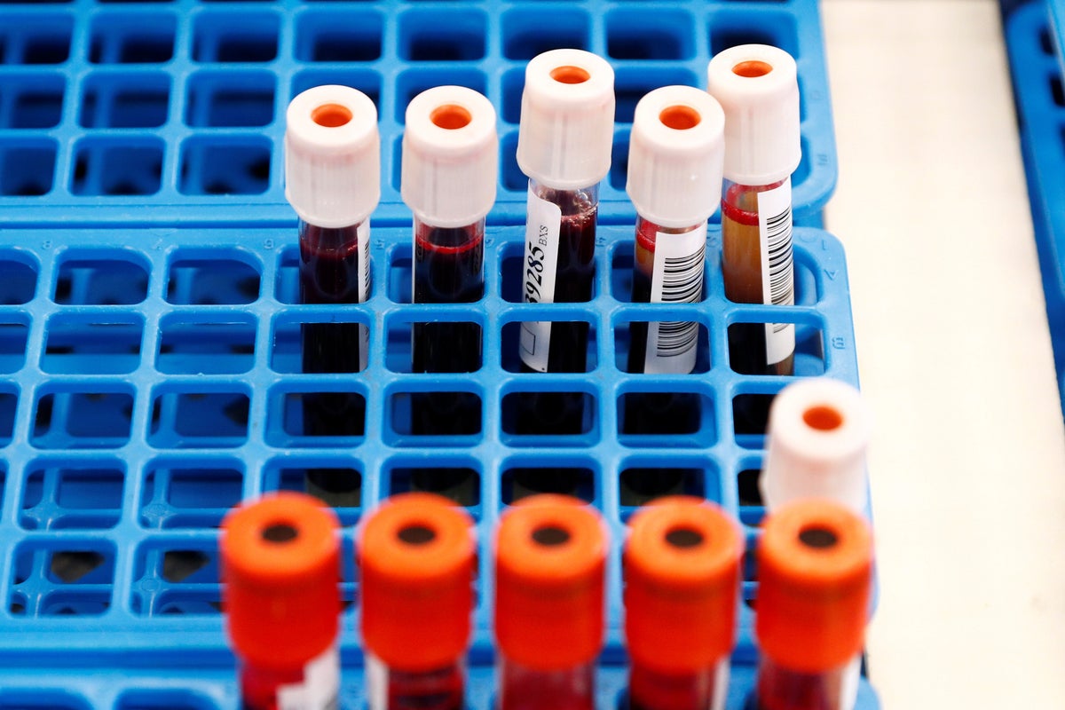 NHS to trial ‘game-changer’ blood test able to detect more than 50 ...