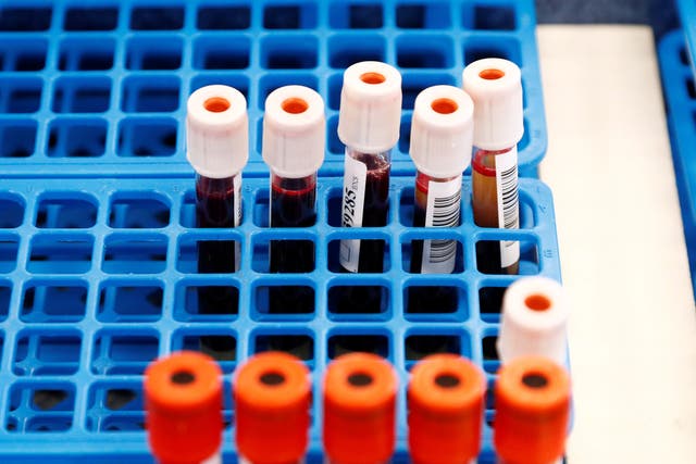 Tubes with blood samples are seen at the Belgian Red Cross blood collection centre during the coronavirus pandemic